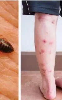 سمپاشی ساس سوسک کنه موش تضمینی در یک جلسه