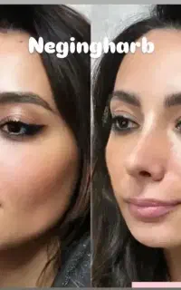 تجربه زیبایی با کلینیک نگین غرب