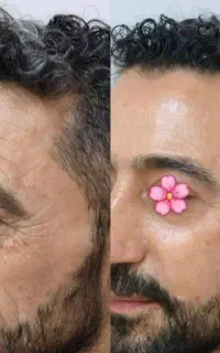 کرم بیوممتیک رفع چین و چروک صورت