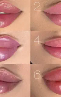 ژل فیلر صورت و بدن مواد اصل کره ای تضمینی