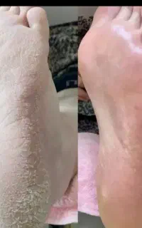 پدیکور .کاشت ناخن .کفسابی پا