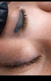 پاکسازی تاتوابروخط چشم بدن ازبین بردن خال