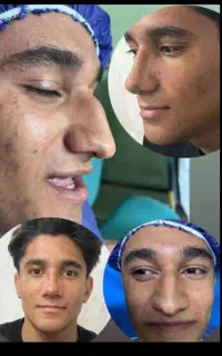 جشنواره عمل بینی باقیمت استثنائی۲۵م