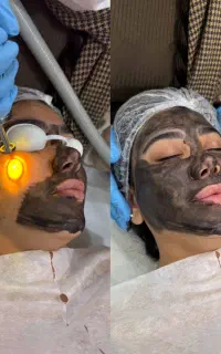پا کردن تتو ابرو و بدن خط چشم / کربن تراپی / لک