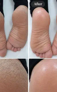 پدیکور درمانی  پدیکور کلاسیک  پدیکور وی آی پی