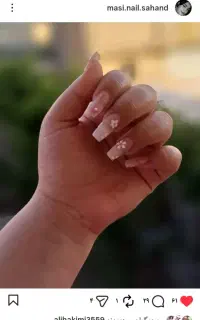کاشت ناخن