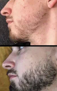 اگه هنوز به خاطر نداشتن ریش سینگلی بیا پیش خودم