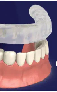 مرکزفوق تخصصی ایمپلنت دیجیتال/سبک کاخ لبخند/یکروزه