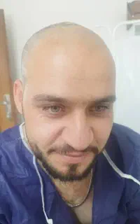 کاشت مو .و.ابرو.خرمدره