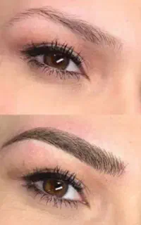 مدل برای فیبروز