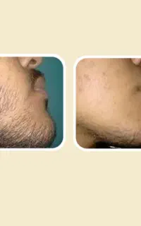 بلیت.کنسرت تغییر
