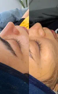 پاکسازی و فیشال پوست