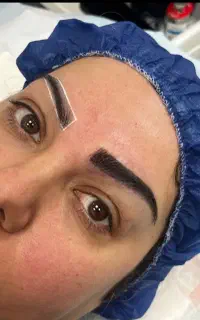 کاشت دائمی ابرو ارومیه