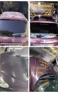 رفع دائم آفتاب سوختگی به ضمانت