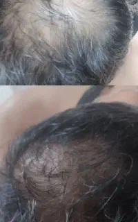 اموزش تخصصی وپیشرفته پی آرپی وبایوفیلر