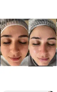 پاکسازی پوست وفشیال هزینه مواد۳۵۰تومن