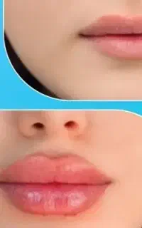 فیلر و بوتاکس تخصصی