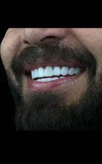 دندانپزشکی ،دندانسازی