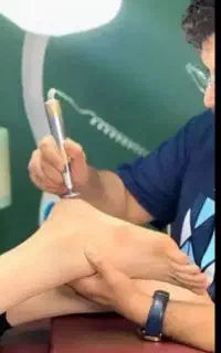 روشن سازی نقاط تیره بدن فیشال صورت پروتز کراتینه