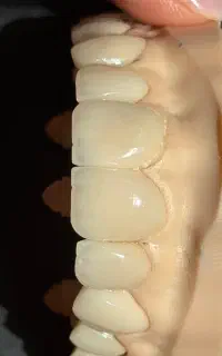 کارآموز خانم لابراتوار دندانسازی
