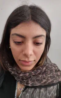 ژل فیلر بوتاکس