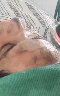 فیشیال پوست