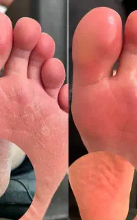 پکیج استثنایی پدیکور ریلکسی و درمانی حرفه ای