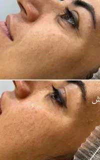 فیشال تخصصی پوست