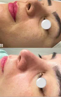 جشنواره فیشال و پاکسازی پوست ( فرصت ویژه )
