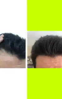 تاسی سرداری یاریشات پرپشت نیست