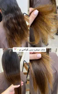 موخوره گیری، به صورت حرفه ای و تخفیف 50 درصدی