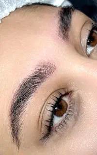 مدل میکروبلیدینگ