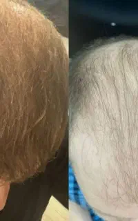 این آخرین روشیه که امتحان میکنی