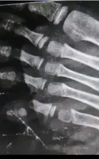خدمات شکسته بند باتجربه