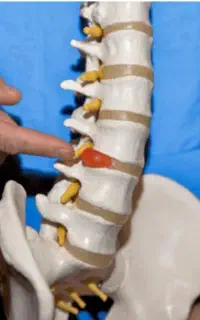 درد سیاتیک یا ارتروز نباید زندگی تو متوقف کنه