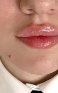 مطب پوست مو و لیزر محمدشهر توسط با تجربه