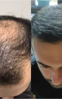 یک تار نازک یک علامت مهم