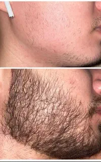 تو قراره دیگه کوسه نباشی