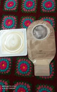 کیسه استومی