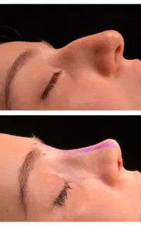 مشاوره جهت جراحـی اقساطی