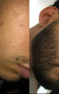 پکیج اروپایی پرپشتی