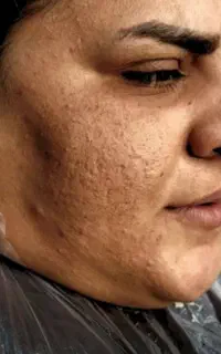 تاتو صورت و بدن پلاسما پرسینگ لیفت مژه و ابر