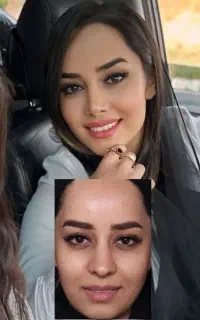 جشنواره عمل بینی