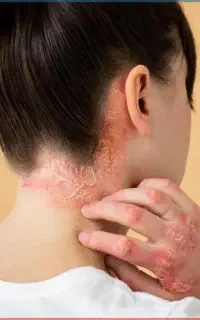 چرخش برات بچرخه