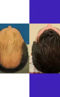 بمب معجزه