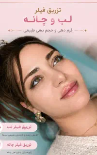 فیلر لب فقط ۹۹۹/۰۰۰(با بوتاکس چشم گربه ای رایگان)
