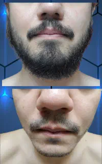 ریش کم‌پشت رو حق خودت میدونی