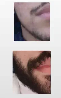 کمتر از یک ماه ریش دار شو