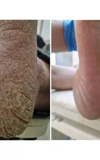 اموزش پدیکور ب روش روسی
