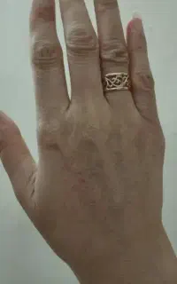 جوانسازی دست روشن کننده